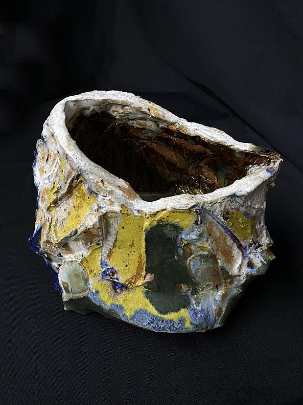 Flattened Vessel -Abhishek Kumar